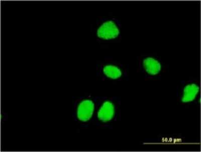 Immunocytochemistry/ Immunofluorescence: ZNF323 Antibody (4F7) [H00064288-M03]