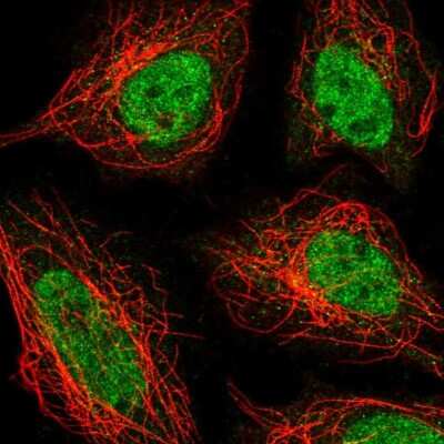 Immunocytochemistry/ Immunofluorescence: ZNF326 Antibody [NBP2-55094]