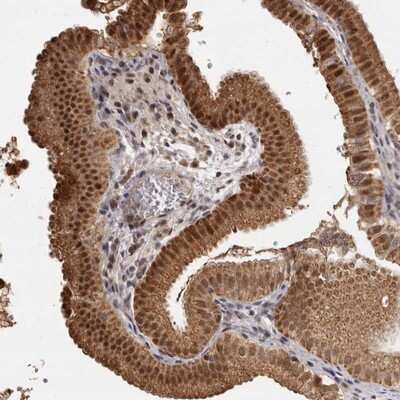 Immunohistochemistry-Paraffin: ZNF326 Antibody [NBP1-83658]
