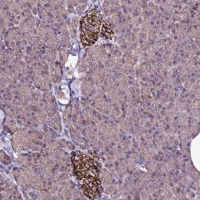 Immunohistochemistry-Paraffin: ZNF329 Antibody [NBP1-92622]