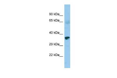Western Blot: ZNF330 Antibody [NBP2-86474]