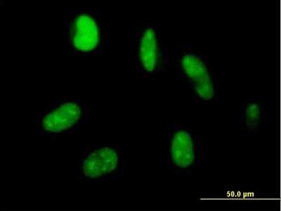 Immunocytochemistry/ Immunofluorescence: ZNF331 Antibody [H00055422-B01P]