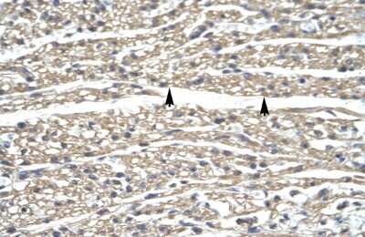 Immunohistochemistry: ZNF336 Antibody [NBP2-83852]
