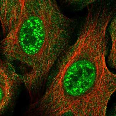 Immunocytochemistry/ Immunofluorescence: ZNF337 Antibody [NBP2-58201]