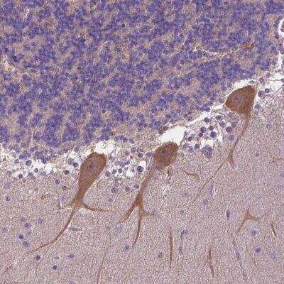 Immunohistochemistry-Paraffin: ZNF337 Antibody [NBP2-49413]