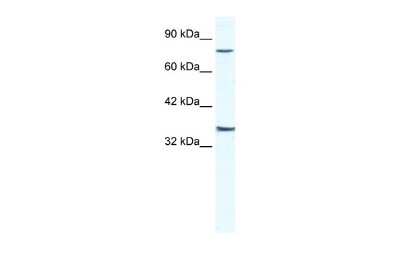 Western Blot: ZNF337 Antibody [NBP2-86478]