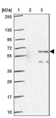 Western Blot: ZNF34 Antibody [NBP2-32564]