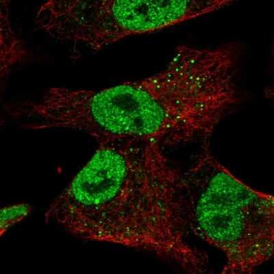 Immunocytochemistry/ Immunofluorescence: ZNF341 Antibody [NBP2-57823]