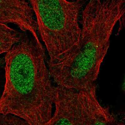 Immunocytochemistry/ Immunofluorescence: ZNF342 Antibody [NBP2-56682]