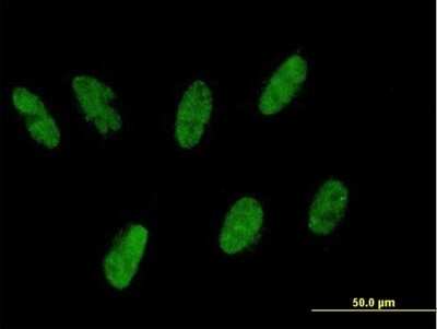 Immunocytochemistry/ Immunofluorescence: ZNF343 Antibody [H00079175-B01P]