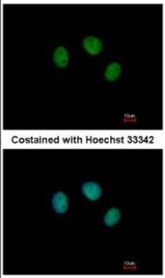 Immunocytochemistry/ Immunofluorescence: ZNF345 Antibody [NBP2-20996]