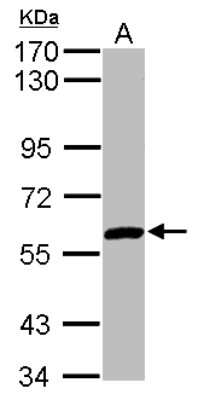 Western Blot: ZNF345 Antibody [NBP2-20996]