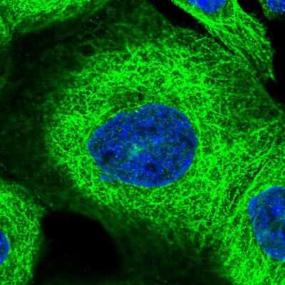 Immunocytochemistry/ Immunofluorescence: ZNF347 Antibody [NBP1-80596]