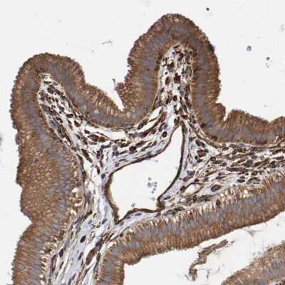 Immunohistochemistry-Paraffin: ZNF347 Antibody [NBP1-80596]