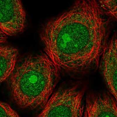Immunocytochemistry/ Immunofluorescence: ZNF354A Antibody [NBP2-13568]