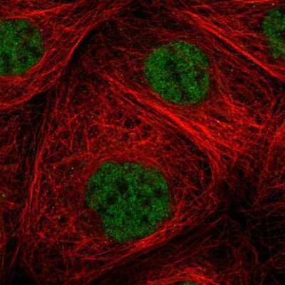 Immunocytochemistry/ Immunofluorescence: ZNF354B Antibody [NBP1-82064]