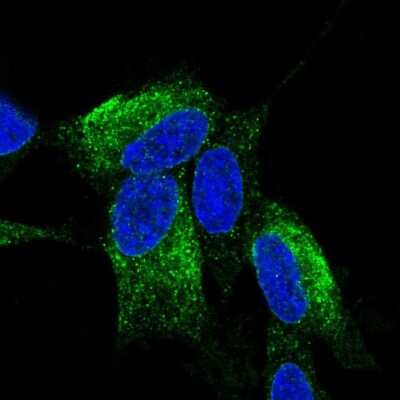 Immunocytochemistry/ Immunofluorescence: ZNF354C Antibody [NBP1-81352]