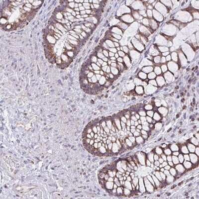 Immunohistochemistry-Paraffin: ZNF362 Antibody [NBP2-31756]