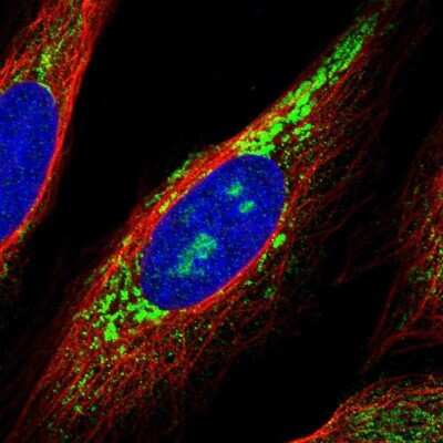 Immunocytochemistry/ Immunofluorescence: ZNF364 Antibody [NBP1-85586]