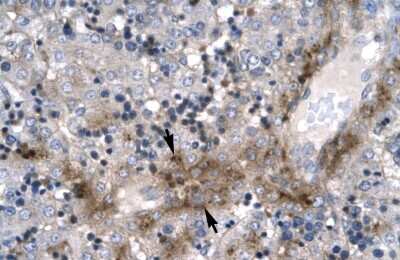 Immunohistochemistry-Paraffin: ZNF365 Antibody [NBP1-79999]