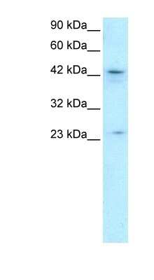 Western Blot: ZNF365 Antibody [NBP1-79999]