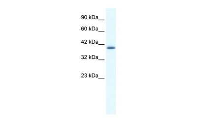Western Blot: ZNF365 Antibody [NBP1-79999]
