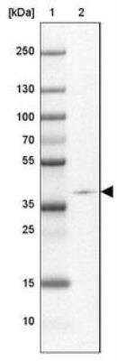 Western Blot: ZNF365 Antibody [NBP2-30451]