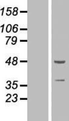 Western Blot: ZNF365 Overexpression Lysate [NBP2-07244]