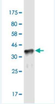 Western Blot: ZNF37A Antibody (4H9) [H00007587-M03-100ug]