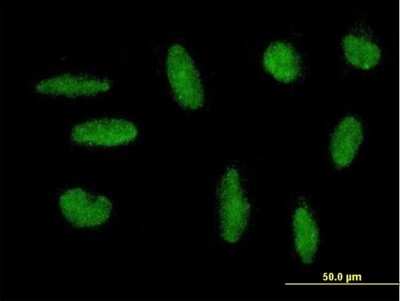 Immunocytochemistry/ Immunofluorescence: ZNF383 Antibody [H00163087-B01P]