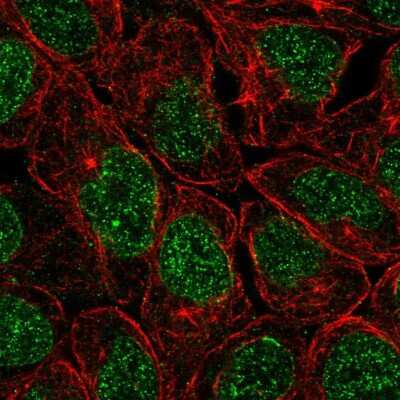 Immunocytochemistry/ Immunofluorescence: ZNF383 Antibody [NBP2-38034]