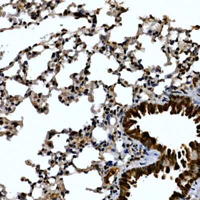 Immunohistochemistry-Paraffin: ZNF384 Antibody - Azide and BSA Free [NBP2-94454]