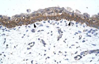 Immunohistochemistry-Paraffin: ZNF385 Antibody [NBP1-79983]