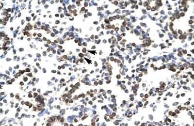 Immunohistochemistry-Paraffin: ZNF385 Antibody [NBP1-80004]