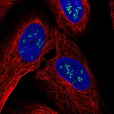 Immunocytochemistry/ Immunofluorescence: ZNF385B Antibody [NBP2-58807]
