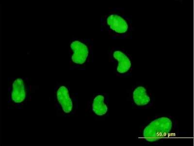 Immunocytochemistry/ Immunofluorescence: ZNF394 Antibody (1F8) [H00084124-M03]