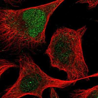 Immunocytochemistry/ Immunofluorescence: ZNF394 Antibody [NBP2-30811]