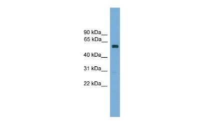 Western Blot: ZNF394 Antibody [NBP3-10431]