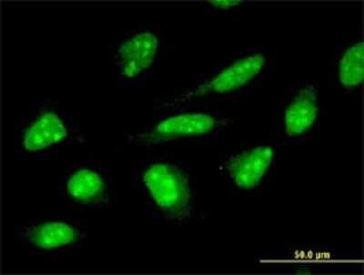 Immunocytochemistry/ Immunofluorescence: ZNF396 Antibody (2F8) [H00252884-M01]
