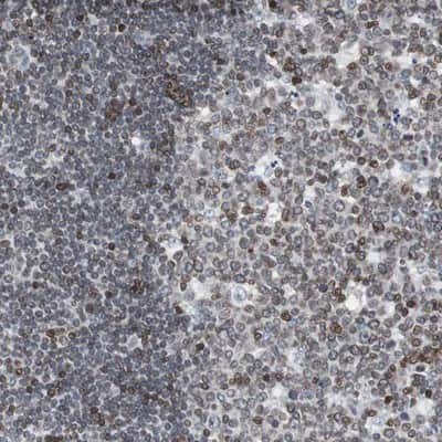 Immunohistochemistry-Paraffin: ZNF396 Antibody [NBP1-82025]