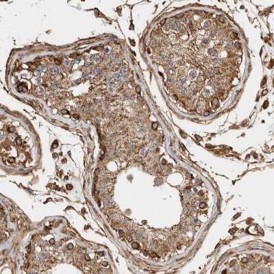 Immunohistochemistry-Paraffin: ZNF397 Antibody [NBP1-82753]