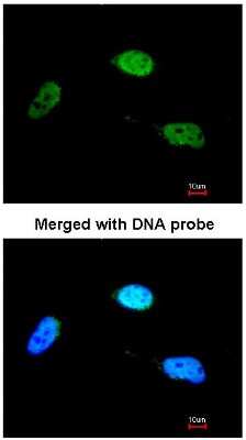 Immunocytochemistry/ Immunofluorescence: ZNF398 Antibody [NBP1-31317]