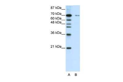 Western Blot: ZNF398 Antibody [NBP2-88682]