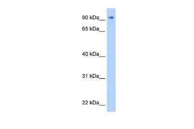 Western Blot: ZNF408 Antibody [NBP2-88686]