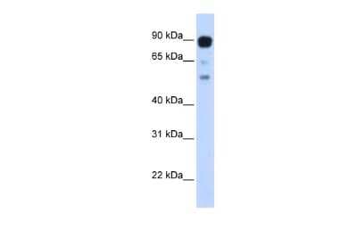 Western Blot: ZNF408 Antibody [NBP2-88687]
