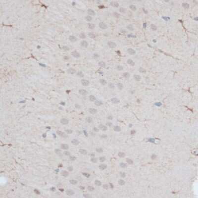 Immunohistochemistry-Paraffin: ZNF415 Antibody - BSA Free [NBP3-04366]