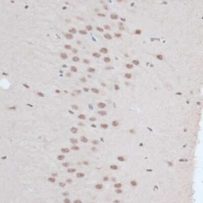 Immunohistochemistry-Paraffin: ZNF416 Antibody - Azide and BSA Free [NBP3-05072]