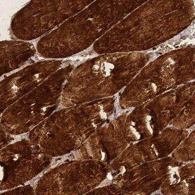 Immunohistochemistry: ZNF417 Antibody [NBP2-46668]