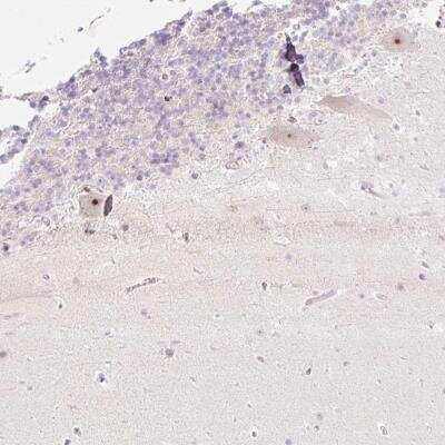 Immunohistochemistry: ZNF417 Antibody [NBP2-46833]