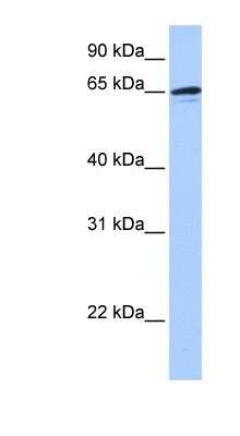 Western Blot: ZNF417 Antibody [NBP1-80159]
